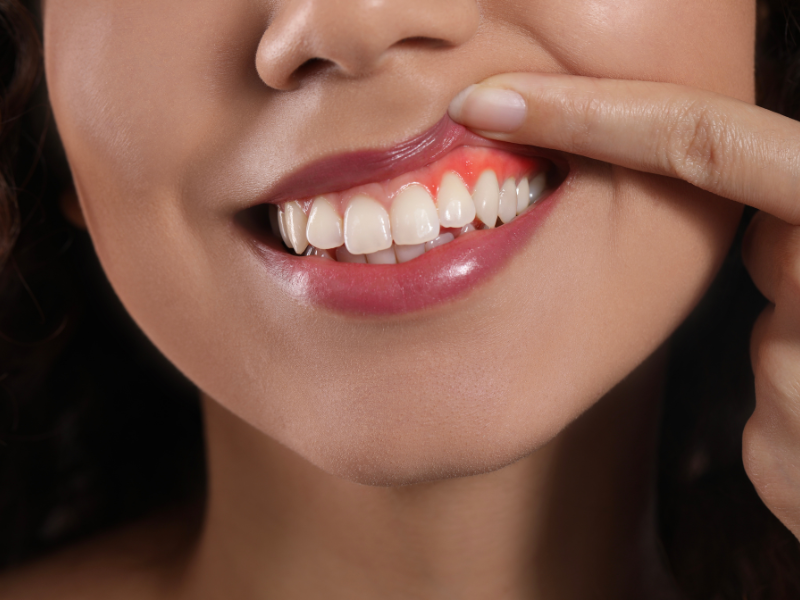 How to Maintain Healthy Gums