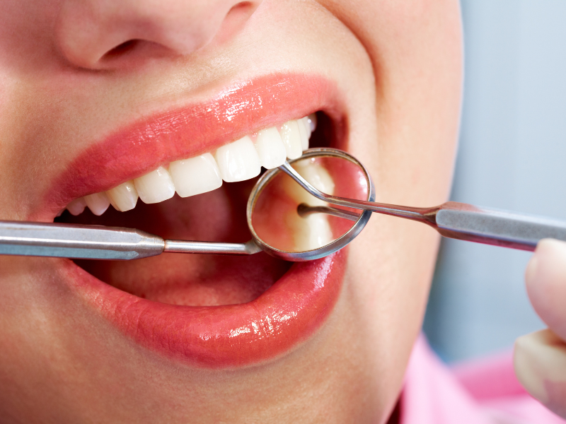 The Importance of Regular Dental Checkups